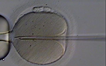 Értelmi fogyatékosságot okozhat az IVF? 