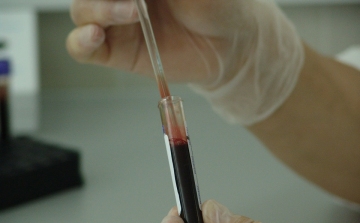 Magyar cég szállíthat vérvizsgálathoz szükséges készülékeket a világ számos részére
